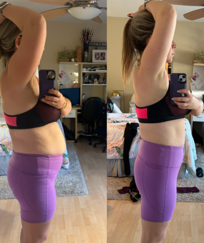 Erin Before & After 2